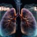 Air pollution and lungs
