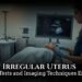 irregular uterus