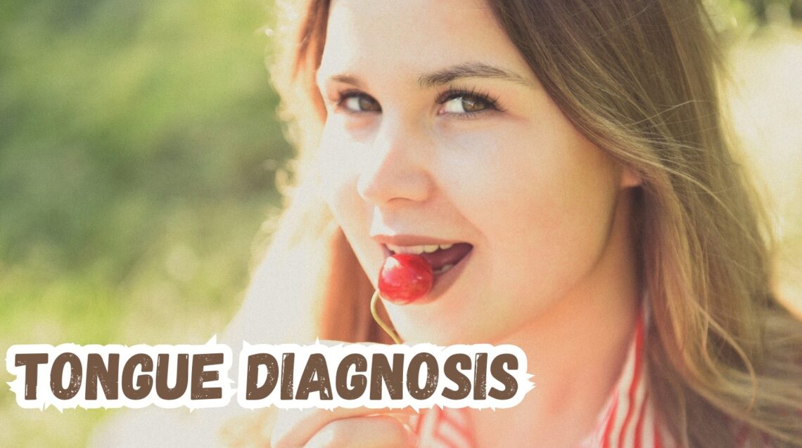 Tongue Diagnosis