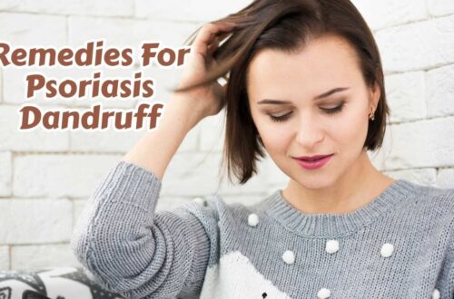 remedies for psoriasis dandruff