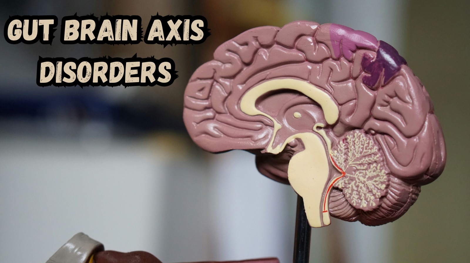 gut-brain axis disorders